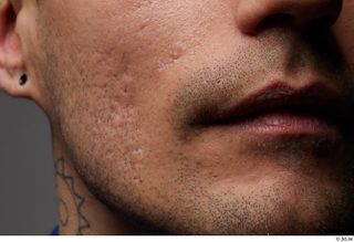 HD Face Skin Shawn Jacobs cheek face lips mouth skin…